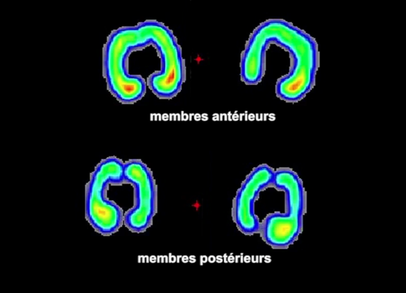 Zones Fragiles Du Pied Boiteries Des Bovins